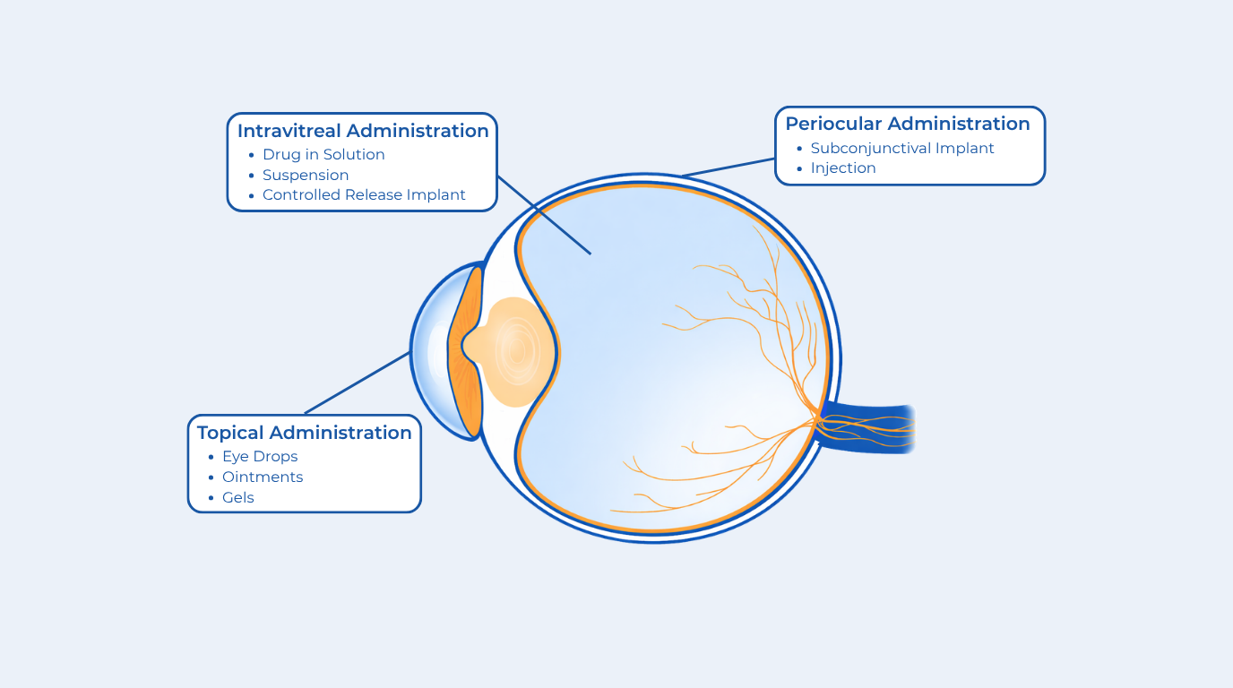 Diagram of ocular drug delivery routes including topical, periocular, and intravitreal administration